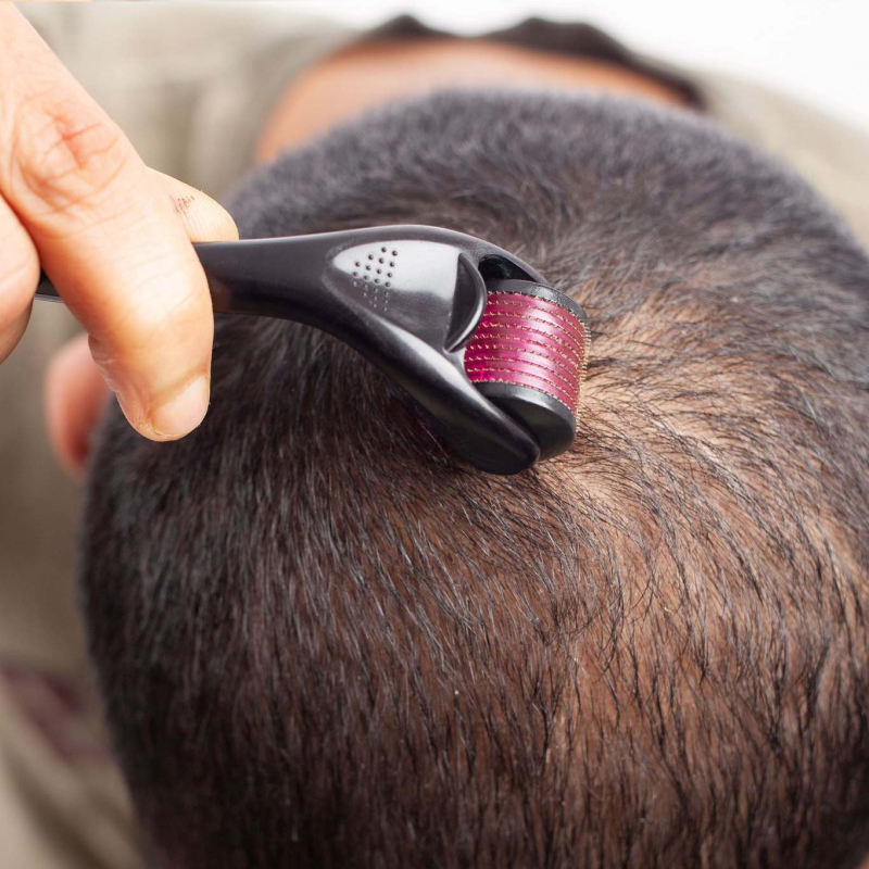 tratamento capilar masculino para queda de cabelo